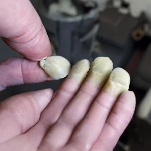 Read more about the article How to clear fungal toenails with doctor divisive £2 . 50 hack